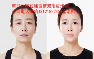 孝感微整形培训学校十强