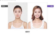 临沂正规微整形培训学校的选择与注意事项