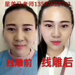 郑州星美国际医美教育 专业的微整形培训学校